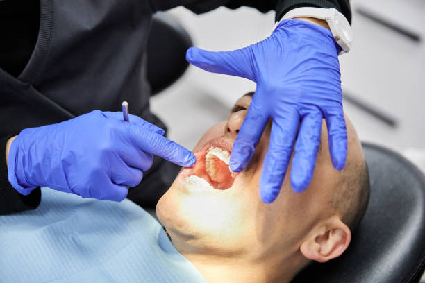Best Knocked-Out Tooth Emergency  in Bottineau, ND